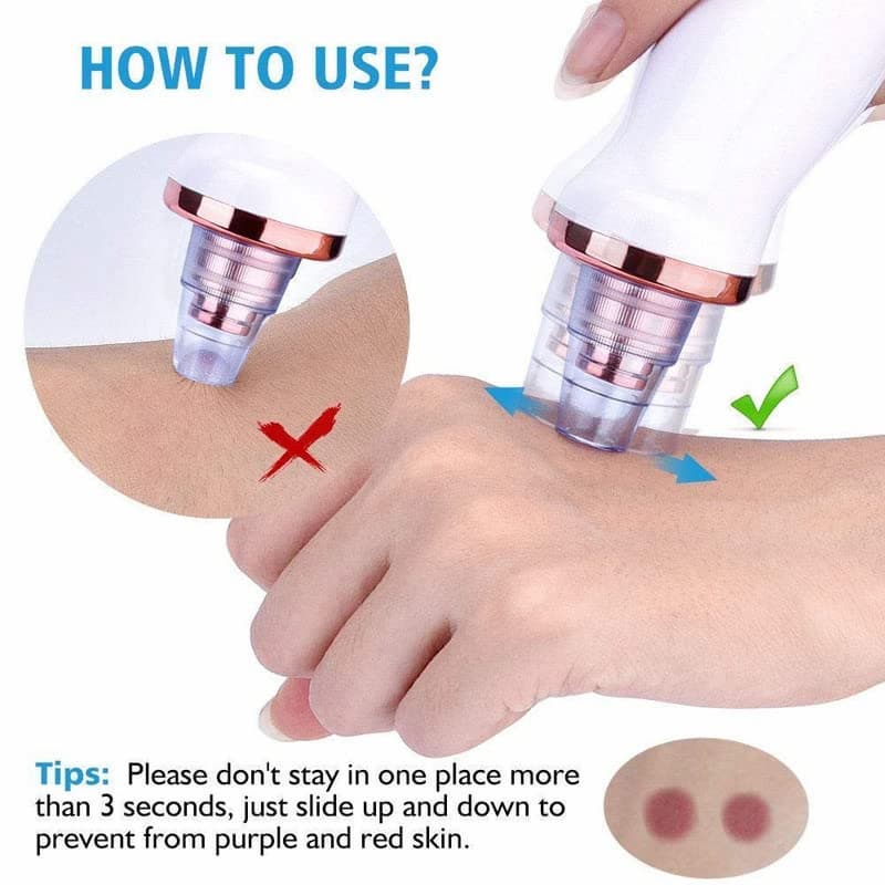 Vacuum Pore Cleaner, 5 In 1 Blackheads Removing Device Electric Derma suction Machine | USB Rechargeable Acne Pimple Pore Cleaner Vacuum tool - Facial Cleanser Device for Nose & Skin Care